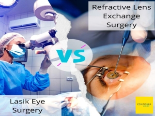 Lasik vs RLE eye surgery