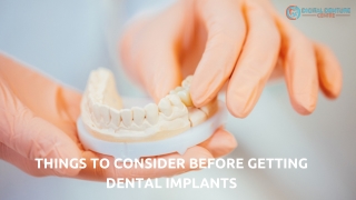 Things to Consider Before Getting Dental Implants