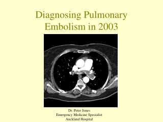 Diagnosing Pulmonary Embolism in 2003