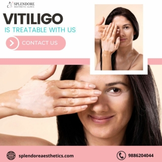 Non-surgical Cosmetic Gynaecology in HSR Layout | Splendore Aesthetic