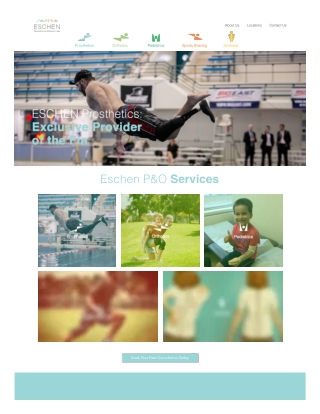 Prosthetics & Orthotics | Osseointegration Prosthetics | Eschen Labs