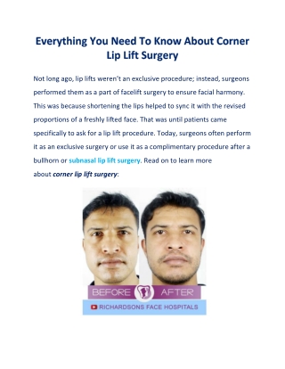 5 Things You Must Know About Corner Lip Lift Surgery