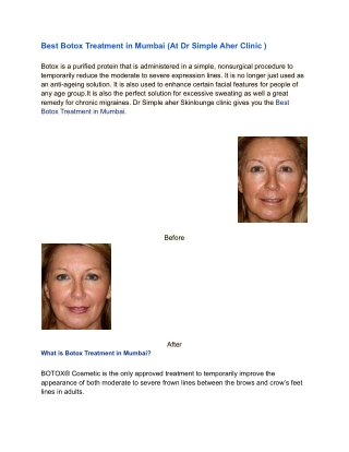 Best Botox Treatment in Mumbai | Skin specialist in lokhandwala