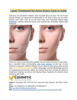 Laser Treatment for Acne Scars Cost in India