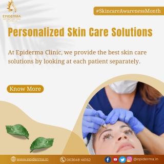 Personalized Skin Care Solutions | Best Skin Clinic in Jayanagar | Epiderma