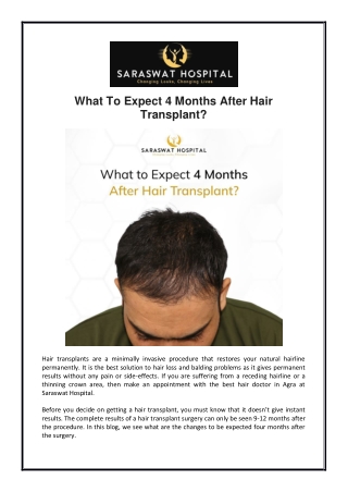 What To Expect 4 Months After Hair Transplant?