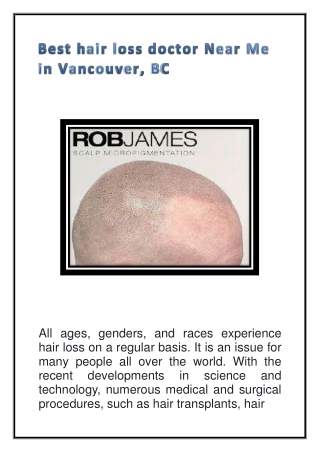 Best hair loss doctor Near Me in Vancouver, BC