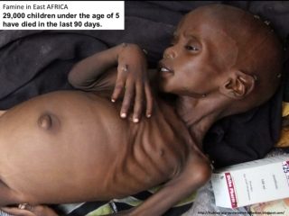 2011 Famine in East Africa