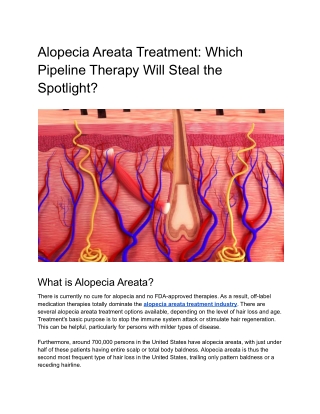 Alopecia Areata Treatment_ Which Pipeline Therapy Will Steal the Spotlight