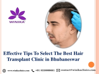 Effective Tips To Select The Best Hair Transplant Clinic in Bhubaneswar
