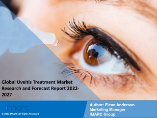 Uveitis Treatment Market PDF: Report, Share, Size, Trends, Forecast by 2027
