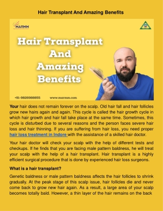 Hair Transplant And Amazing Benefits.docx
