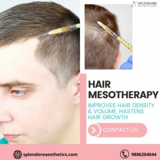 Best Hair Loss Treatment in HSR Layout | Splendore Aesthetic Clinic