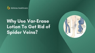 Why Use Var-Erase Lotion To Get Rid of Spider Veins