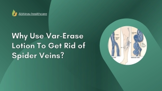 Why Use VarErase Lotion To Get Rid of Spider Veins