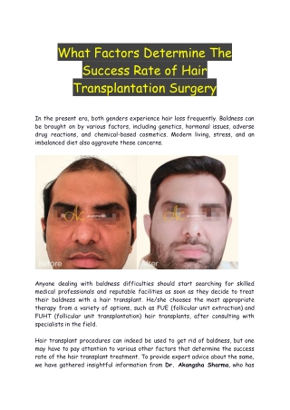 What Factors Determine The Success Rate of Hair Transplantation Surgery