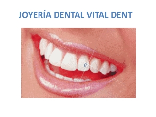 Vitaldent Badajoz y la joyería dental