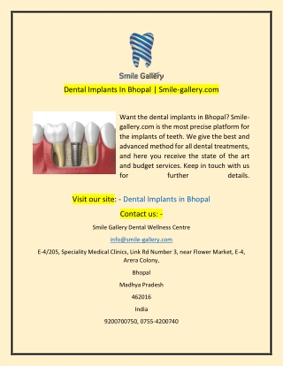 Dental Implants In Bhopal Smile-gallery