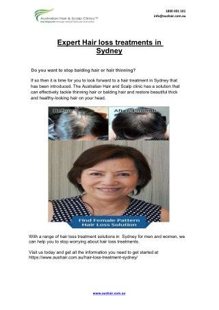 Expert Hair loss treatments in Sydney