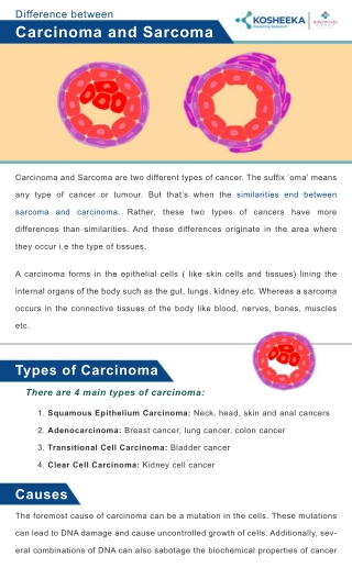 Carcinoma vs. Sarcoma: Types, Causes