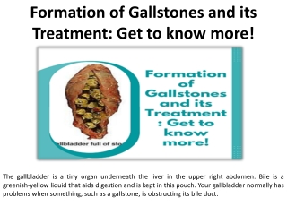 Gallstones treatment Find out more right away