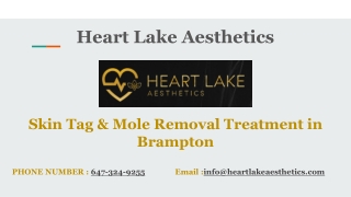 Skin Tag & Mole Removal Treatment in Brampton