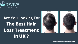 Hair Loss Treatment