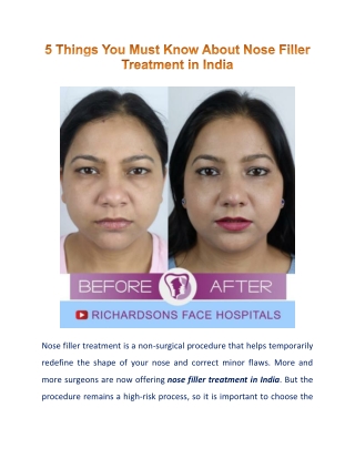 Everything You Need to Know About Nose Filler Treatment in India