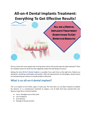 All-on-4 Dental Implants Treatment: Everything To Get Effective Results!