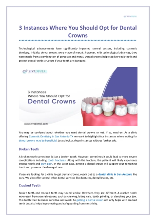 3 Instances Where You Should Opt for Dental Crowns