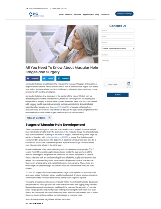 All You Need To Know About Macular Hole Stages and Surgery