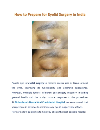3 Tips to Help You Prepare for Eyelid Surgery in India