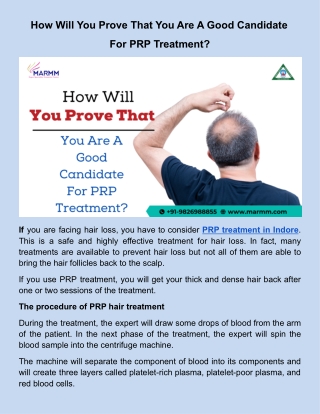 How Will You Prove That You Are A Good Candidate For PRP Treatment_.docx