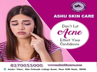ashu ashu skin care is best for  pimples treatment clinic in bhubaneswar, odisha