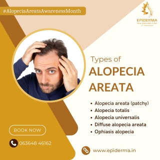 Types of Alopecia Areata | Best Hair Clinic in Jayanagar | Epiderma Clinic