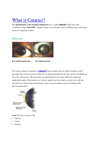 Best Hospital for Cataract Surgery in Mumbai