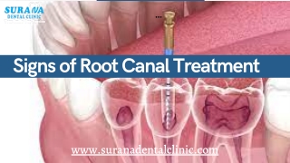 Find Top Dental Clinic in Indore – Surana Dental Clinic