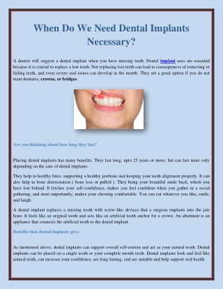 When Do We Need Dental Implants Necessary?