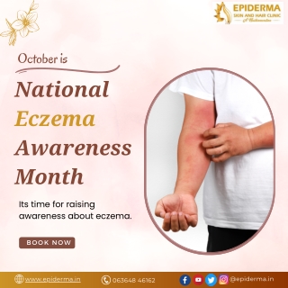 October is National Eczema Awareness Month | Best Skin Clinic in Jayanagar