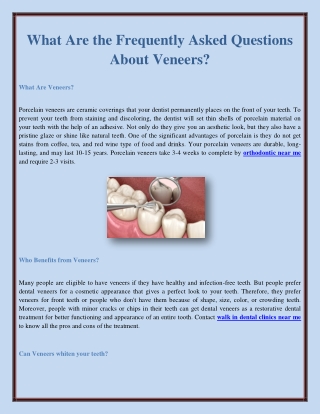 What Are the Frequently Asked Questions About Veneers?