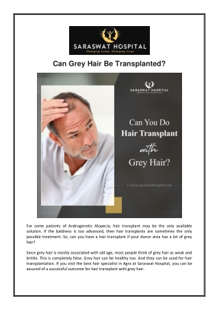 Can Grey Hair Be Transplanted?