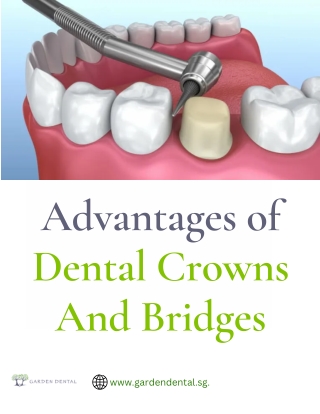 Advantages of Dental Crowns And Bridges
