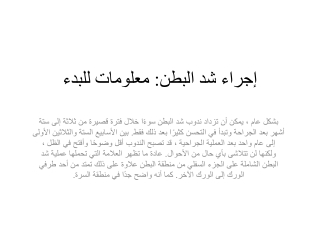 إجراء شد البطن معلومات للبدء