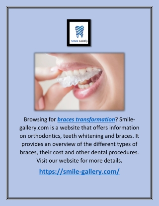 Braces Transformation | Smile-gallery.com