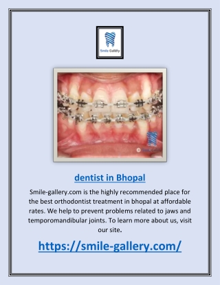 dentist in bhopal | Smile-gallery.com
