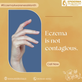 Eczema is not contagious | Best Skin Clinic in Jayanagar | Epiderma Clinic