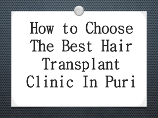 How to Choose The Best Hair Transplant Clinic In Puri