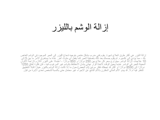 إزالة الوشم بالليزر