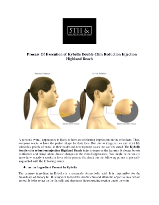 Process Of Execution of Kybella Double Chin Reduction Injection Highland Beach