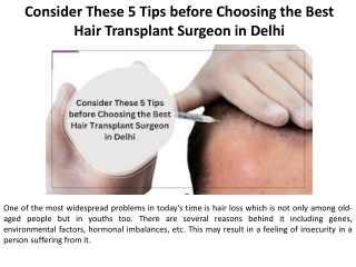 Please keep the following tips in mind while you search for the best hair transplant surgeon in Delhi.